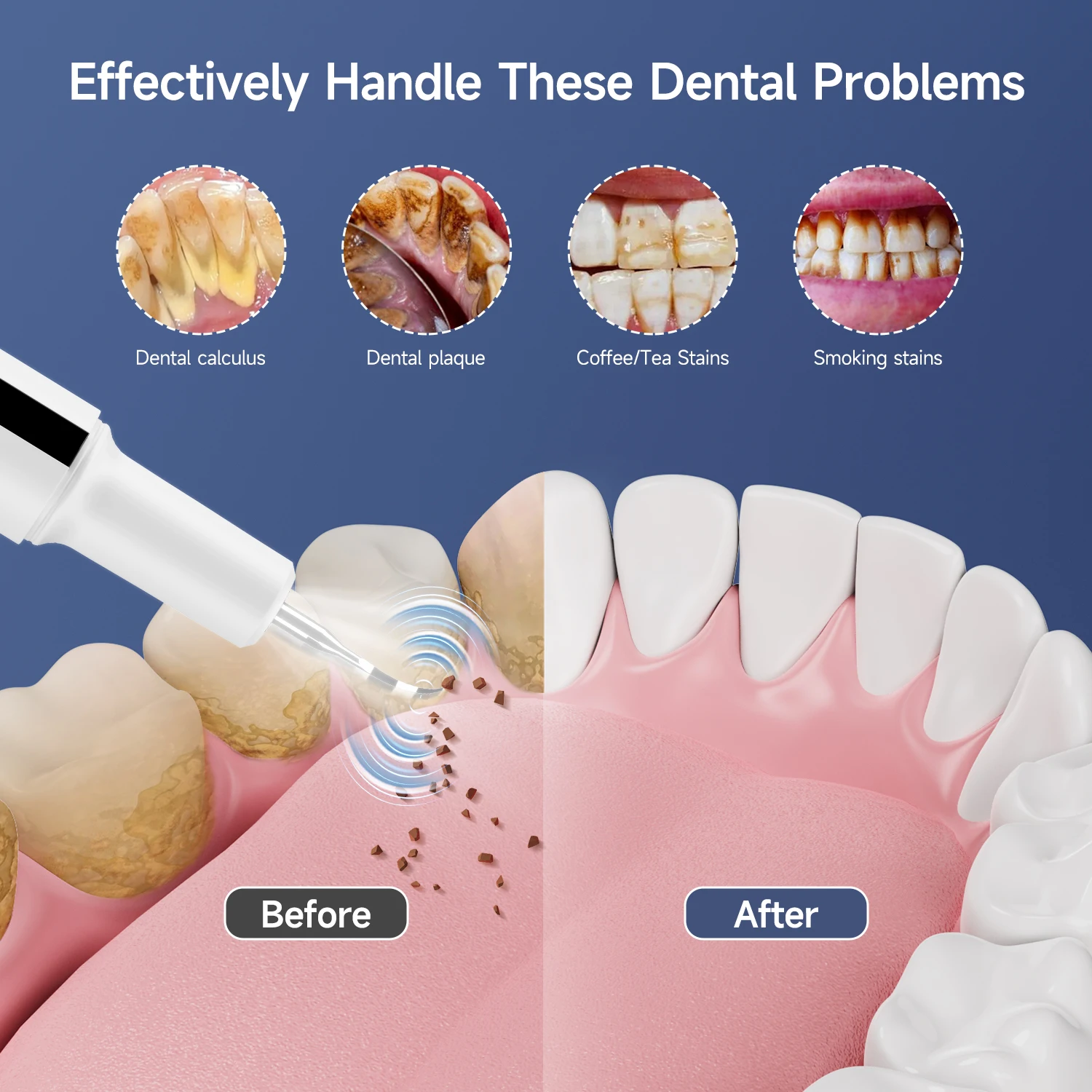Curvy moon t7 limpador de dentes ultrassônico elétrico removedor de tártaro ferramentas de limpeza de manchas de dente clareamento dental limpo cuidados pessoais