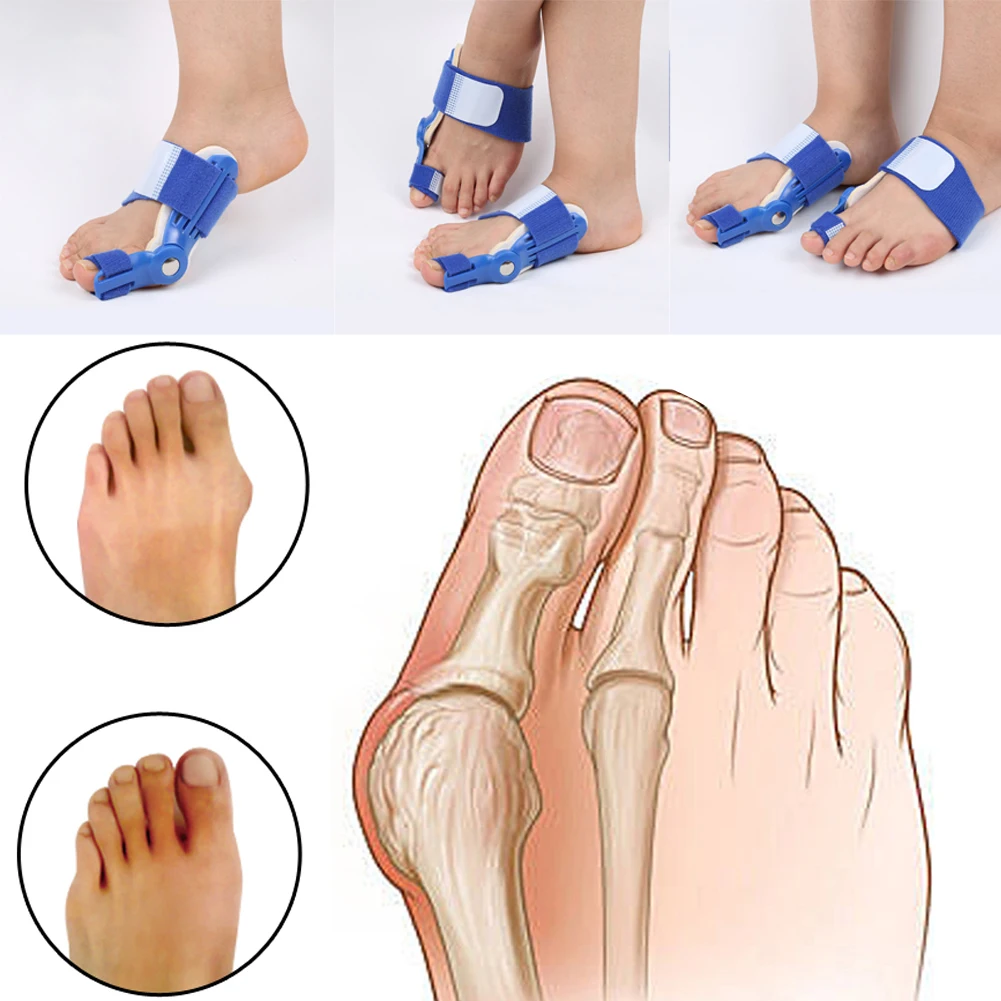 Orthotics Big Toe Corrector Hallux Valgus Foot Pain Relief Feet Guard Care Bone Corrective Bunion Night Day Splint Straightener