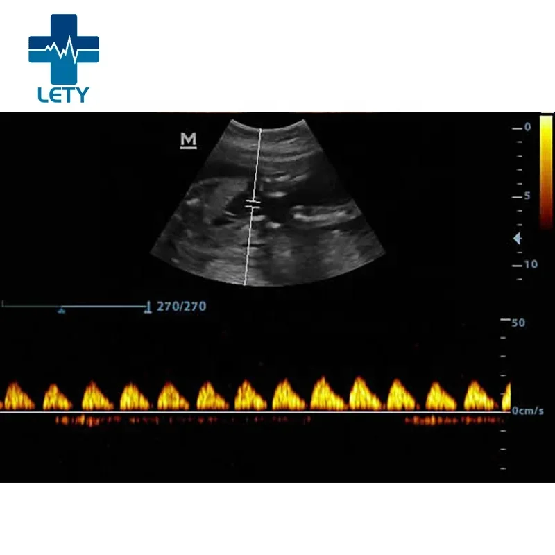 DP10 Mindray Ultrasound Machine B/W System Better Than Mindray Dp10 Medical Scan Portable Touch Screen Ultrasound