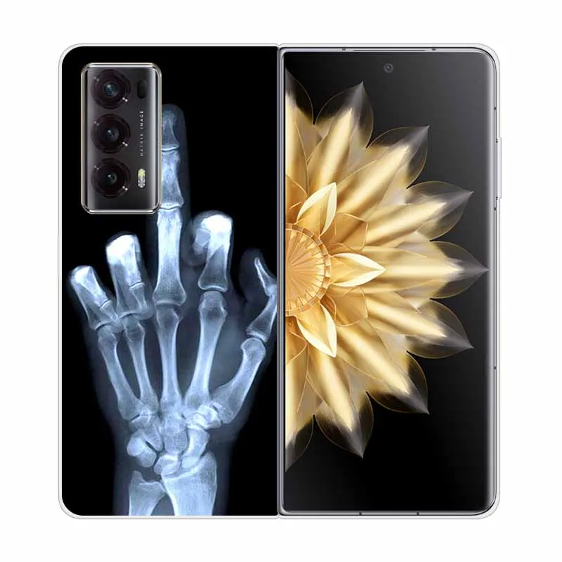 Hard Case For Honor Magic V2 Case Cover Clear Print Transparent Phone Cover for Honor Magic V2 5G Protect Shell Capa Wolf Lion