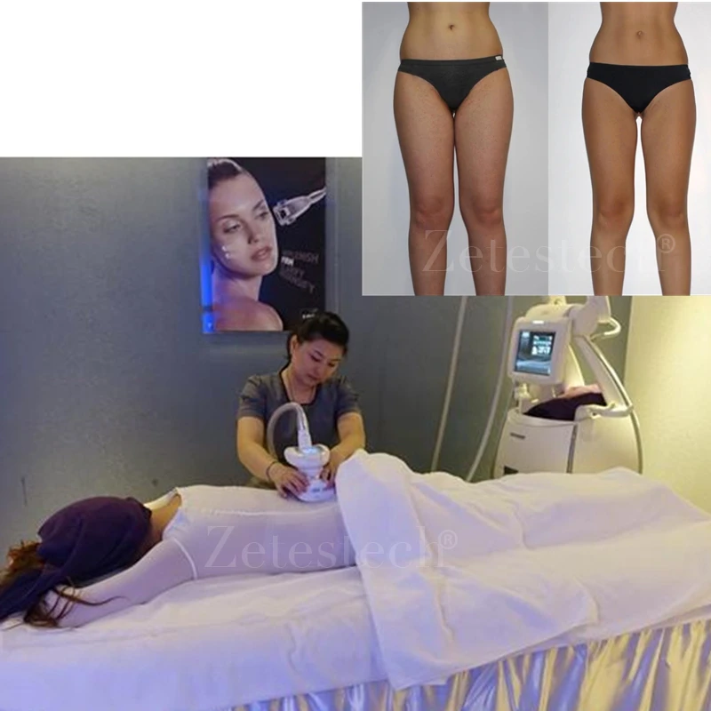 Massage Bodysuit For SPA and Endermologie Vacuum Roller Treatments Disposable Underwear Slimming Massage Machine Accessories