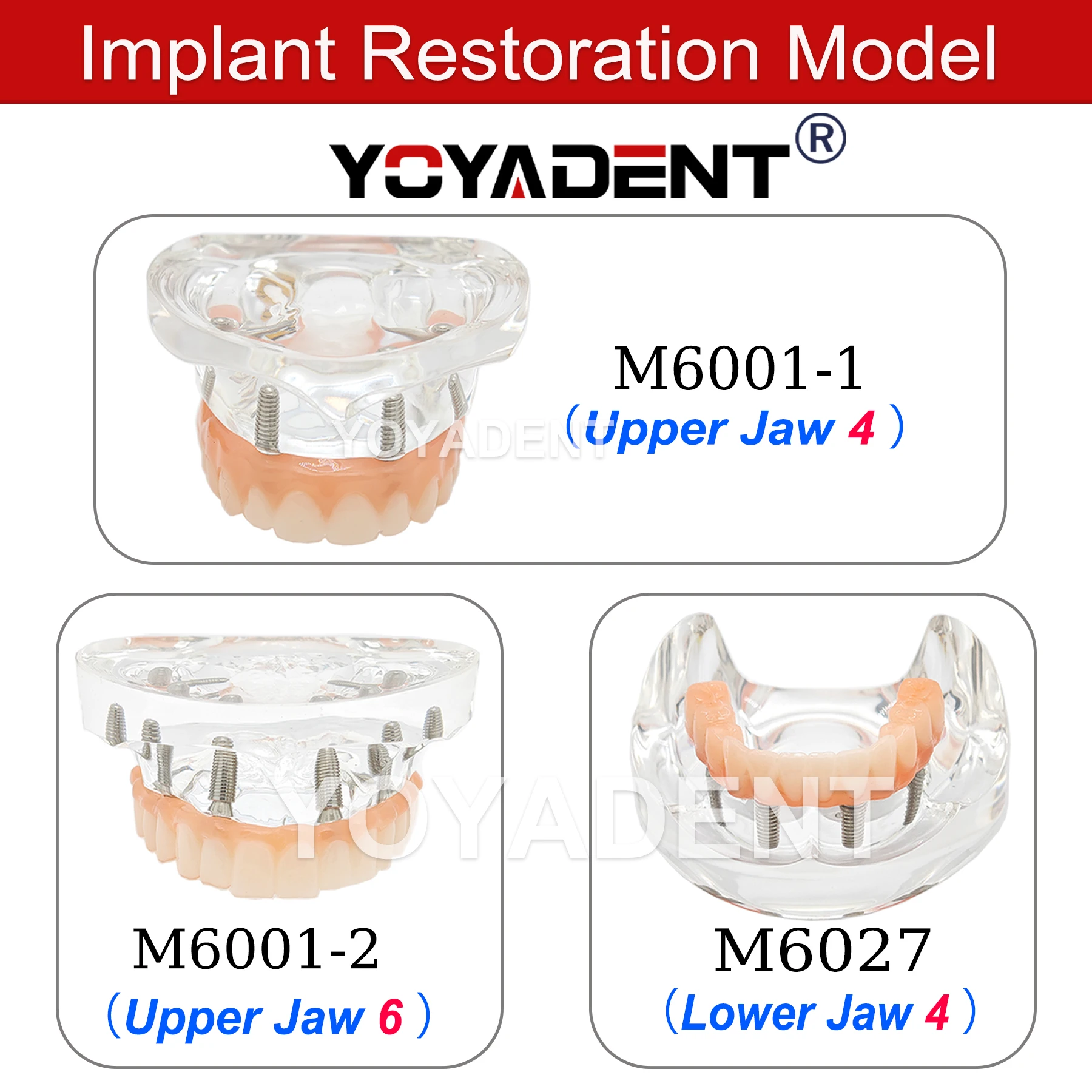 

Модель зубов для имплантации с 4 винтами, прозрачная, для верхней/нижней челюсти, модели для реставрации ортопедических протезов M6027 M6021