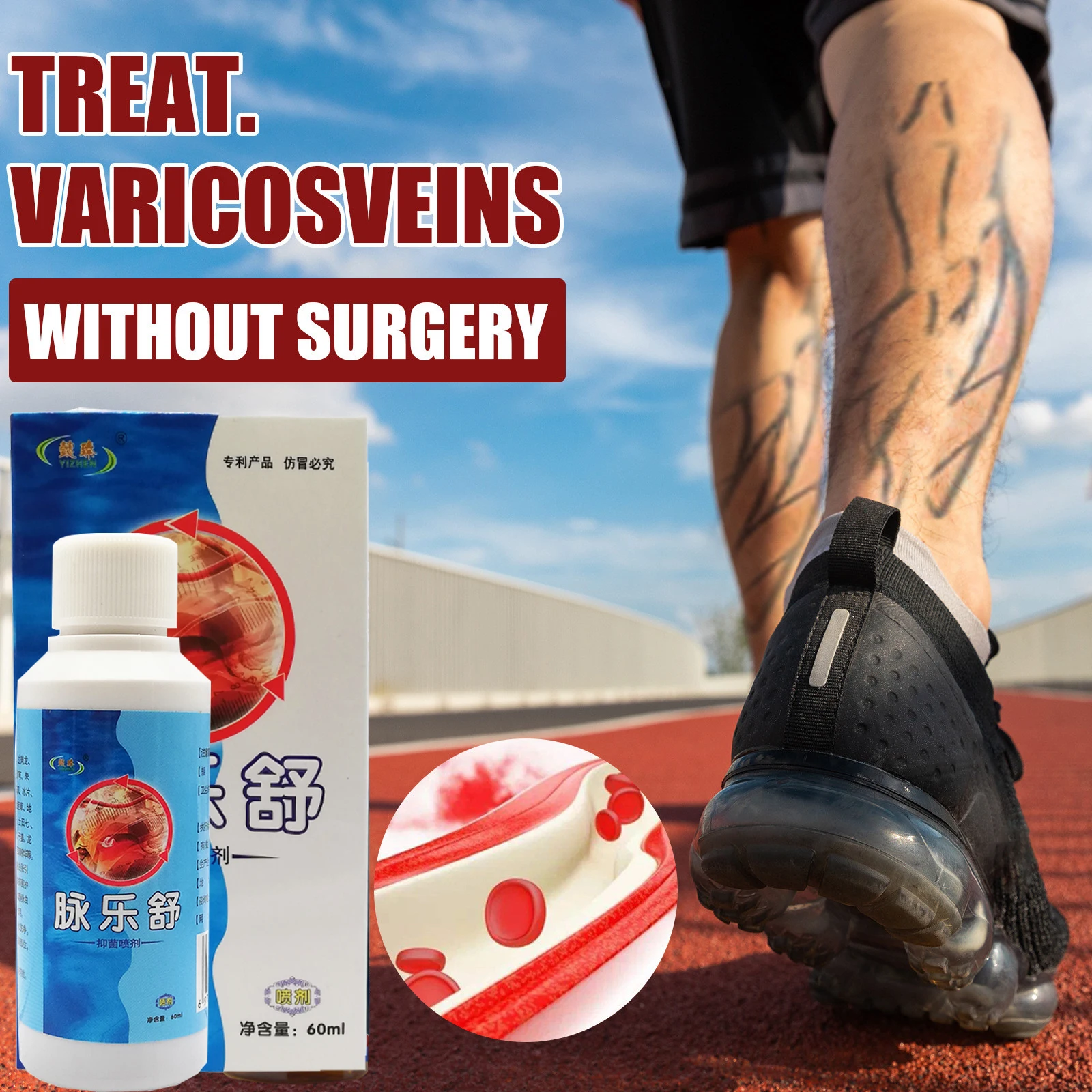 Varicose Veins Spray Blood Vessels Bulge Relief Phlebitis Angiitis Remedy Edema Nerve Pain Spider Edema Nerve Leg Active Liquid