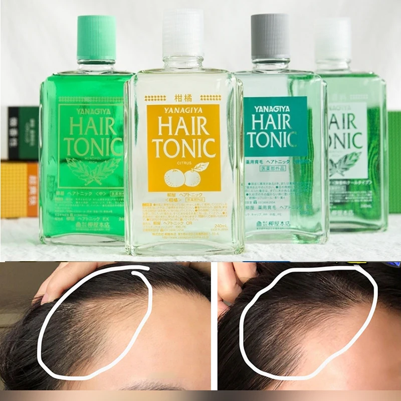 Tinh Chất Dầu Bưởi Dưỡng Tóc Hair Tonic Kích Thích Mọc Tóc Salon De Pro Nhật Bản 240ml