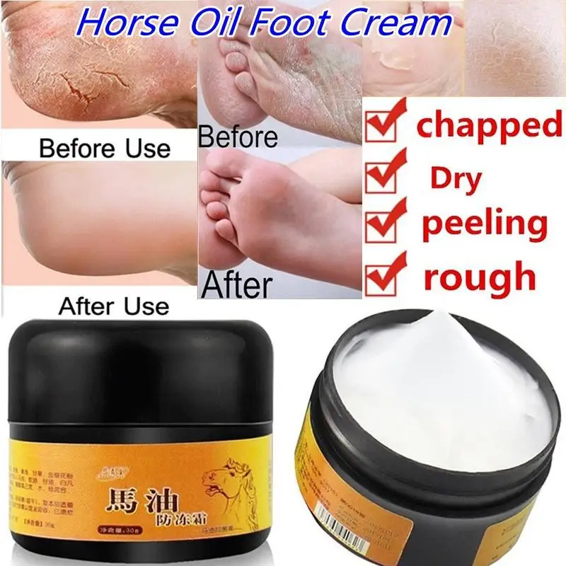 

Horse Oil Hand and Foot Repair Cream Foot Cream Care Cream Beriberi and Itchy Feet Blisters Prevent Chapped