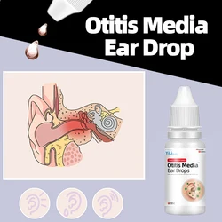 Otitis Media Cure Ear Drop 10Ml Ear Pain Itching Acute Otitis Bacterial Infection Treatment Ear Wax Cleaner Remover Drops