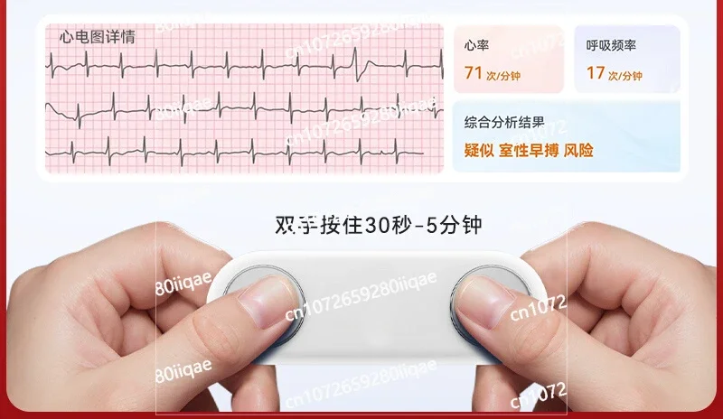 

Medical electrocardiogram detector ECG monitor heart rate heart home portable dynamic atrial fibrillation premature beat