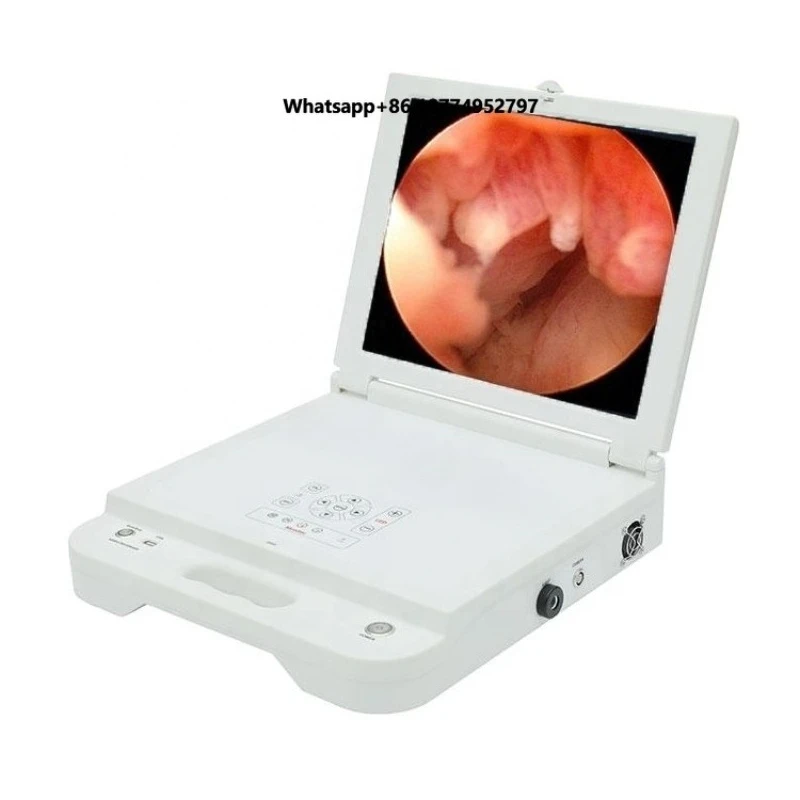 Portable 4 in 1 full high definition otolaryngology endoscopy system/medical 3 in 1 endoscopy