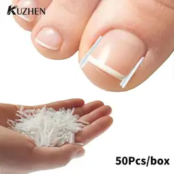 50Pcs Ingrown Toenail Correction Tool Ingrown Toe Nail Treatment Elastic Patch Sticker Straightening Clip Brace Pedicure Tool