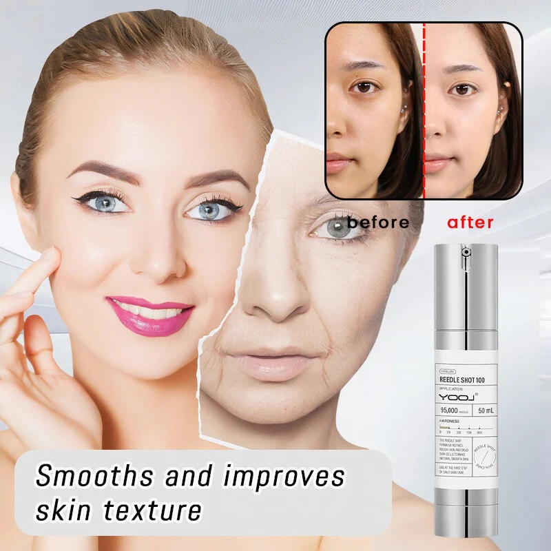 

Korean Microneedle Essence Desalination Fine Lines Spots Collagen Solution Reverse Aging Recombinant Improves Rough Texture 50ml