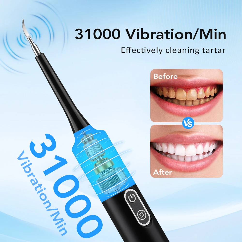 Electric Dental Scaler with Teeth Brush Head Calculus Tartar Remover Vibration Teeth Plaque Cleaner Oral Care Improve Odor image 3