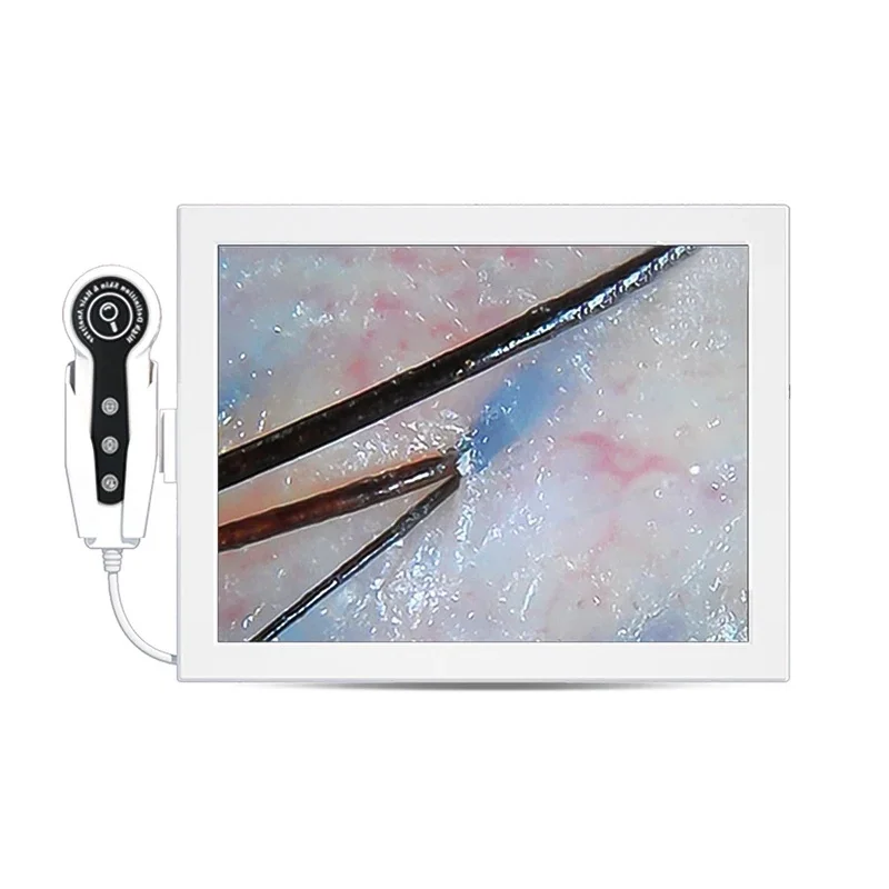 15 inch home use digital HD screen skin and hair analyzer machine, help you analyze skin and hair, scanner with
