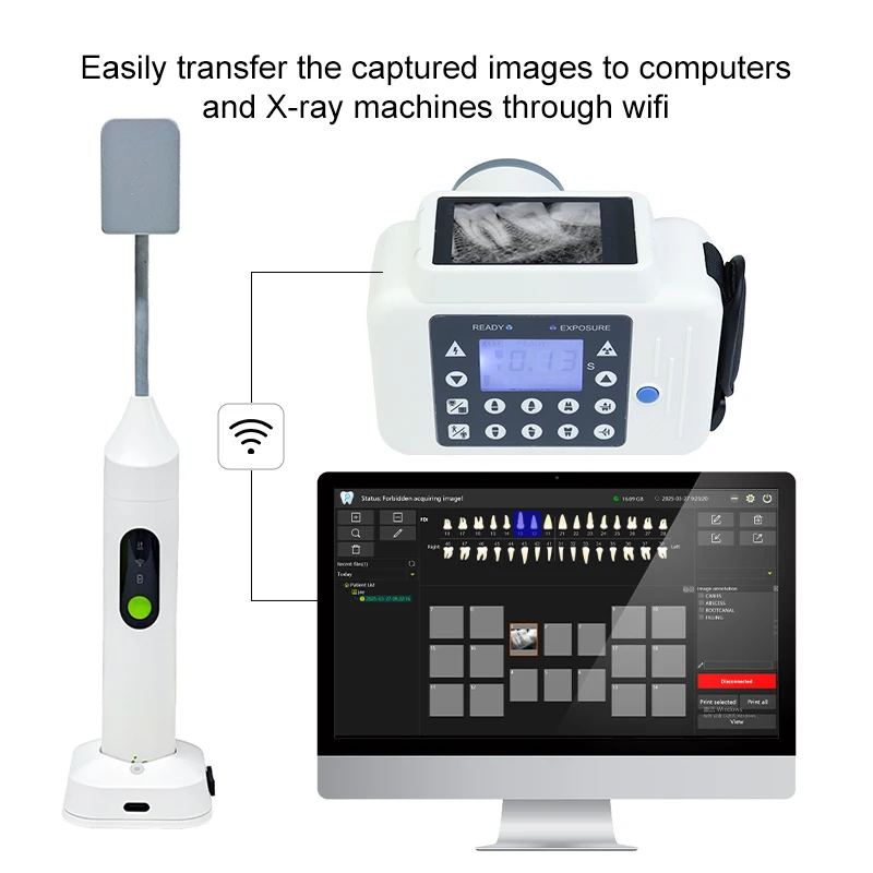 

New Digital Wireless Intraoral X-Ray Sensor CMOS Detector Technology Low Dose Clinical Imaging Dentistry Equipment