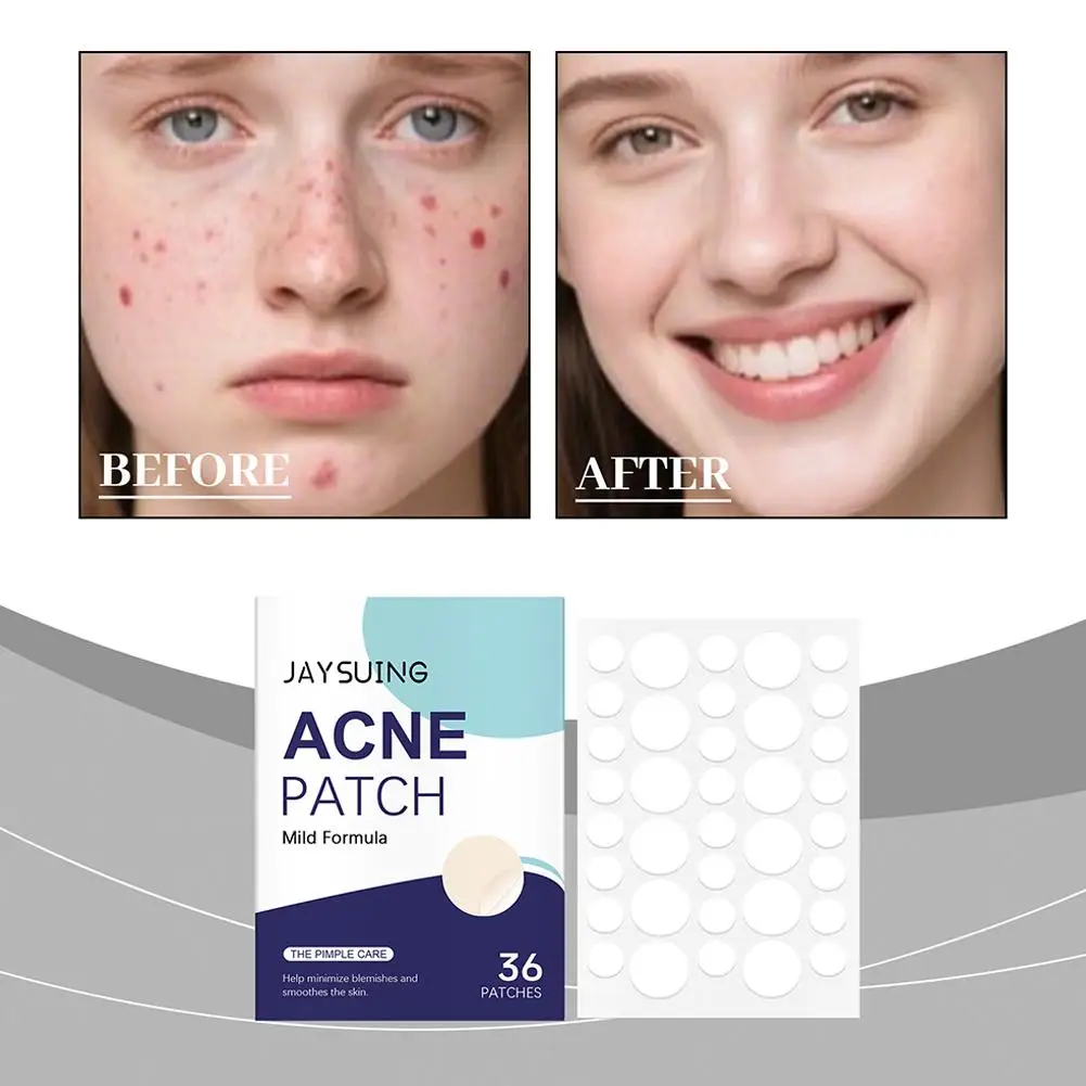 

Горячий пластырь для ухода за лицом, невидимый закрытый пластырь от прыщей, невидимый дышащий невидимый пластырь для кожи лица, акне, водостойкий I7Z0