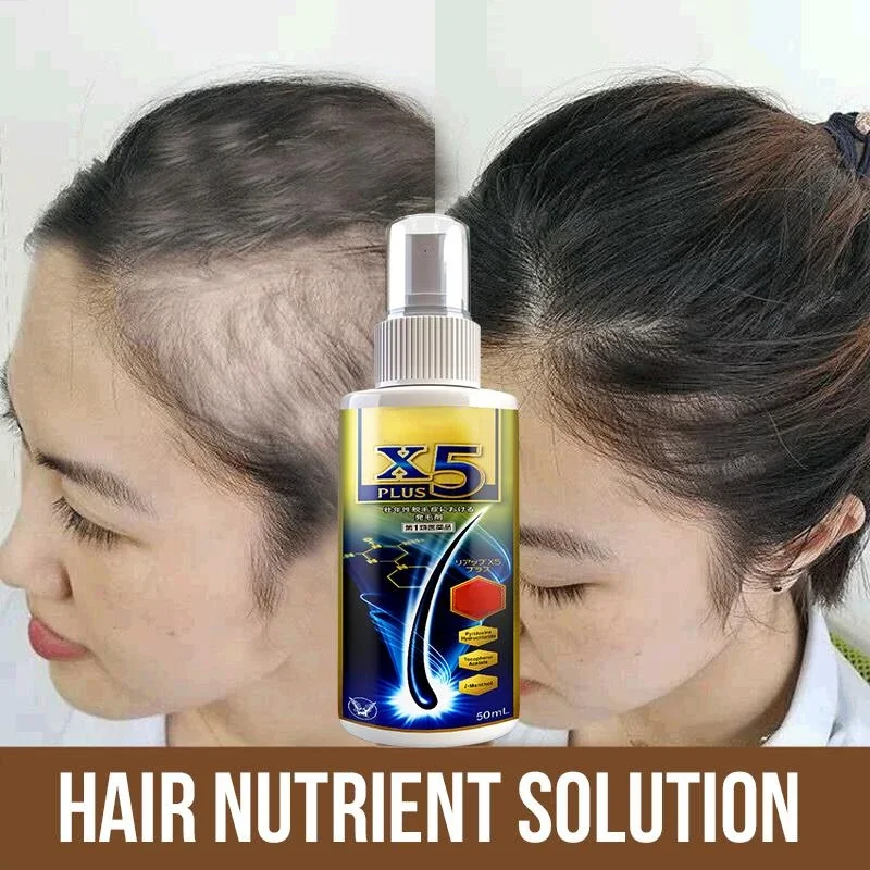 Hairloss Hair Natural Fast Growth Essential Oil Product Anti Hairloss Treatment Growth Essence Alopecia Hair Treatment for Women