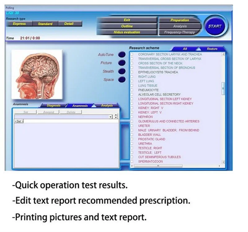 2023년 핫세일 3D NLS 양자 바이오 공명 분석기 자기 공명 검사기 신체 건강 분석기 (소프트웨어 포함)