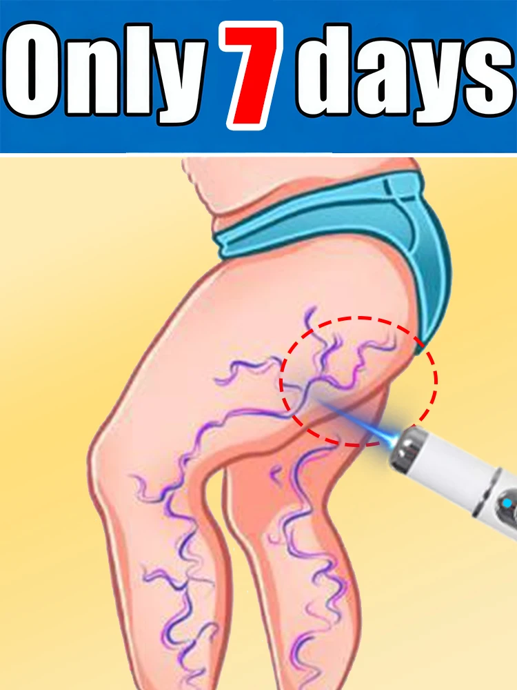 Blue light pen about vein,No trouble,Body Easy and comfortable,Unisex