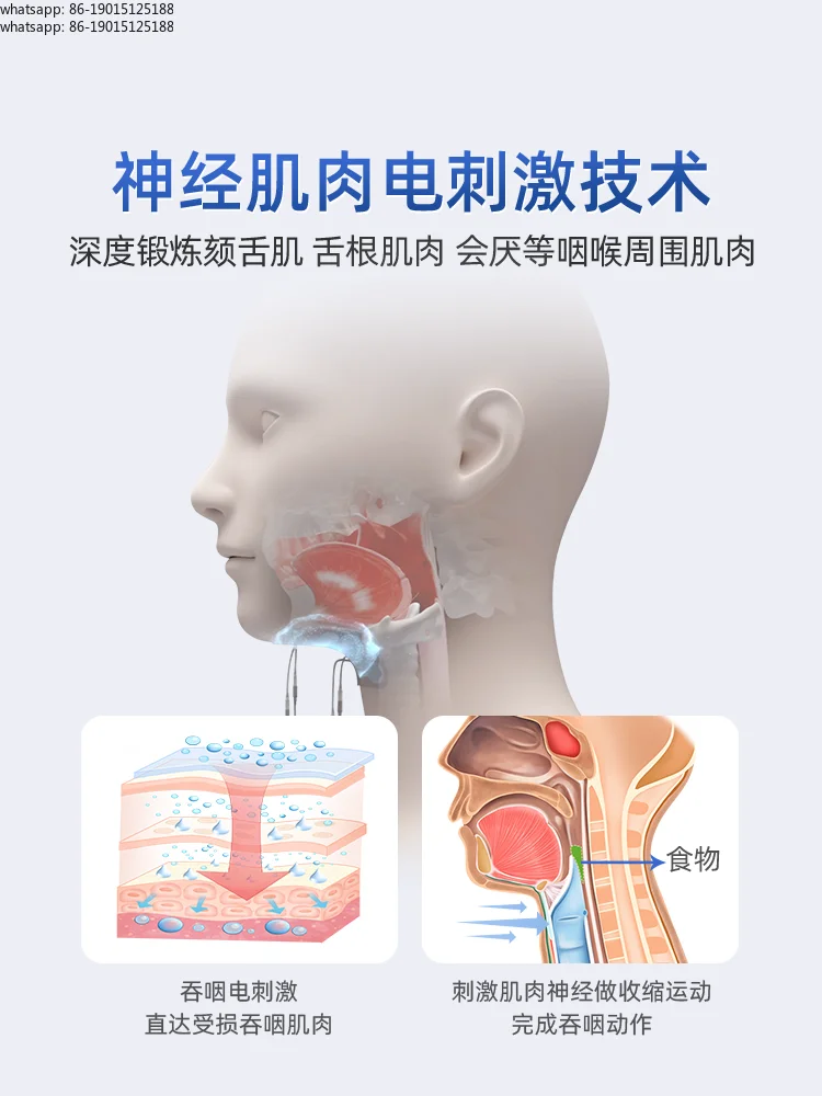 Swallowing disorder treatment, training rehabilitation device eating difficulties neuromuscular electrical stimulation equipment