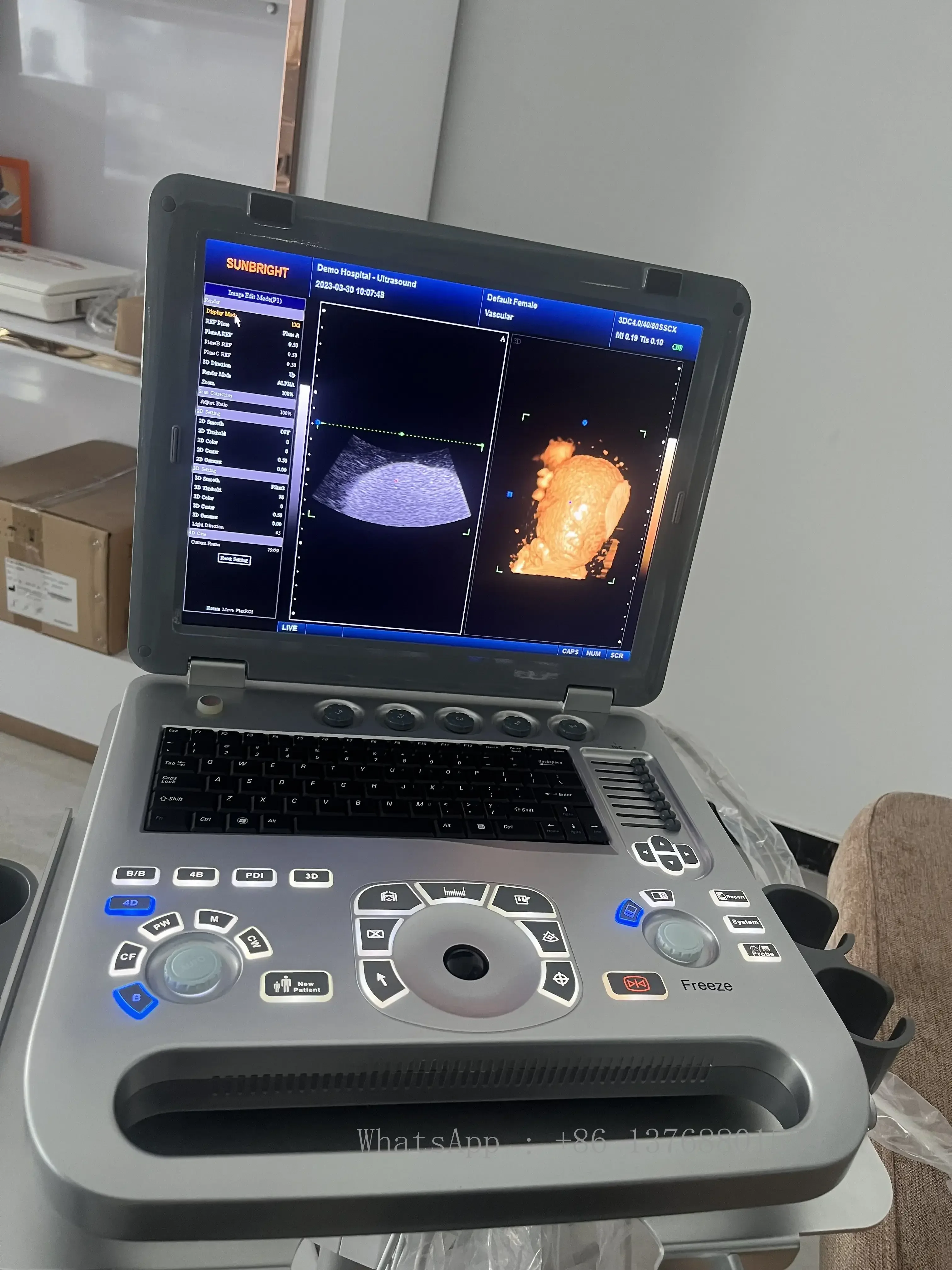 Ultrasound Human Veterinary Ultrasound Portable 4D Real Time Color Doppler Ultrasound SUN-906B