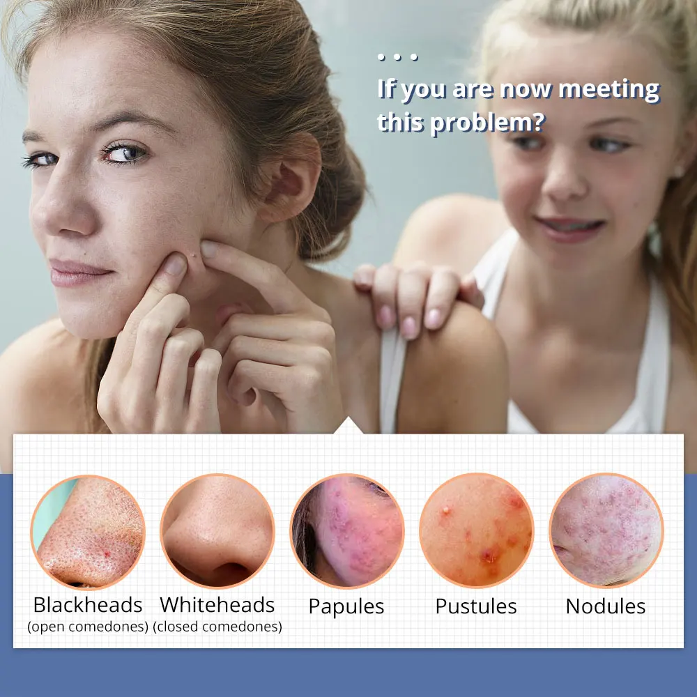 6-in-1 ultrasone huidscrubber Foton Microdermabrasie Sproeier Koelmachine