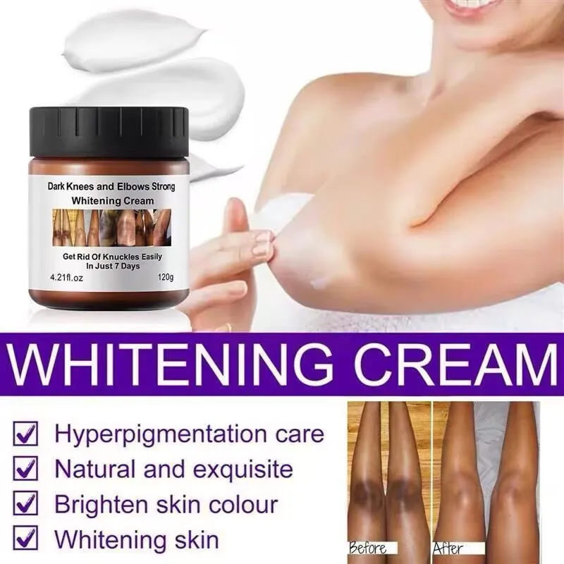 crema-sbiancante-intensa-per-ginocchia-e-gomiti-scuri-crema-per-macchie-scure-e-melanina-120g