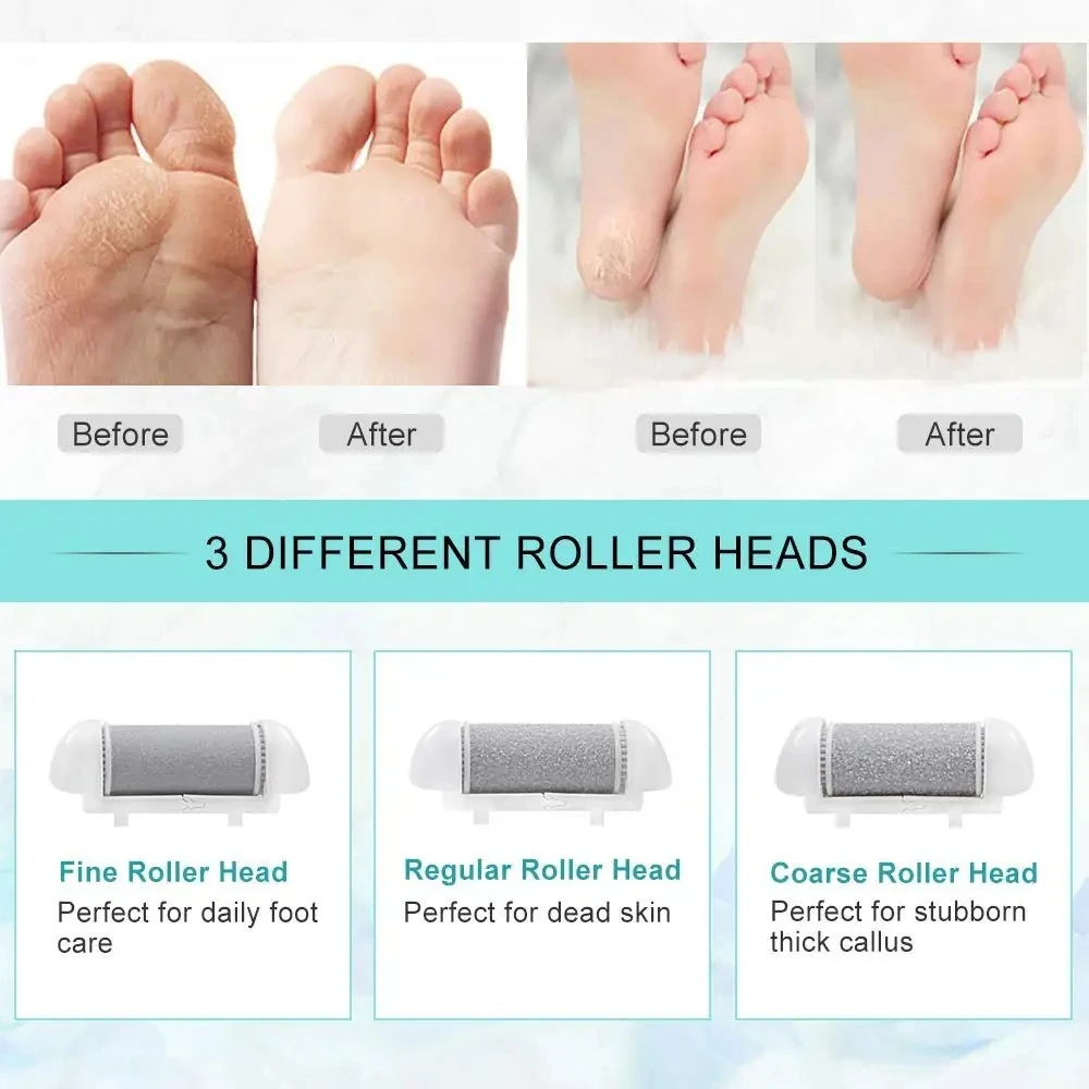 6PCS Foot Care Tool Heads Dead Hard Skin Callus Remover Refills Grinder Replacement Rollers File Feet Care Tool