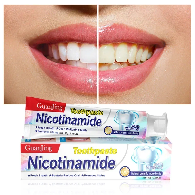 Niacinamide Whitening Toothpaste Fresh Breath Whitening Teeth Cleaning To Remove Bad Breath Effectively Treating Dental Calculus