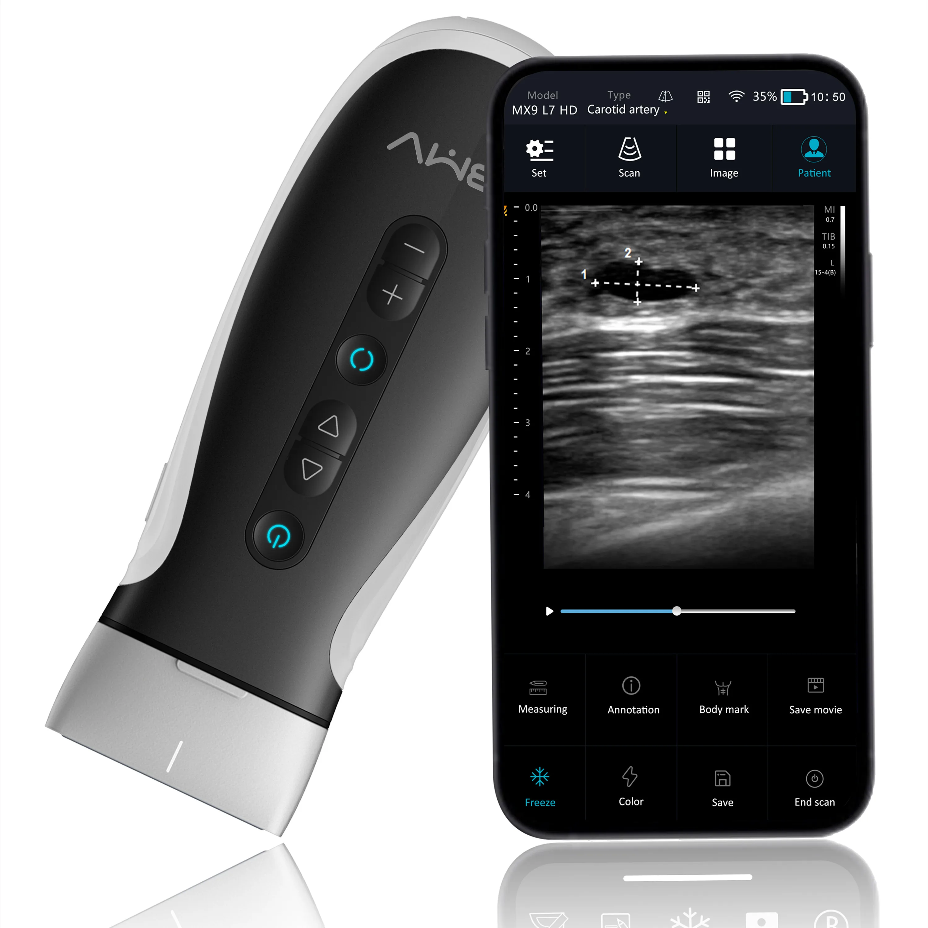 New Arrival USB Ultrasound Scans Convex Linear Ultrasound BMV MX9 wireless probe pocket ultrasound scanner probe wifi