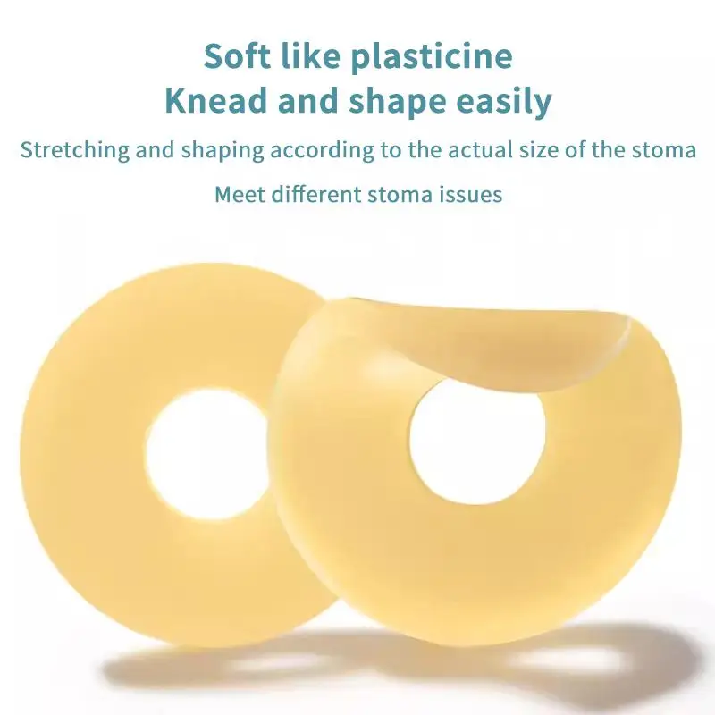 Stoma-Paste Anti-Auslauf-Ringe 10 Stück Weiche Medizinische Kolostomie-Dichtungen für die tägliche Ostomiepflege – Detail 3