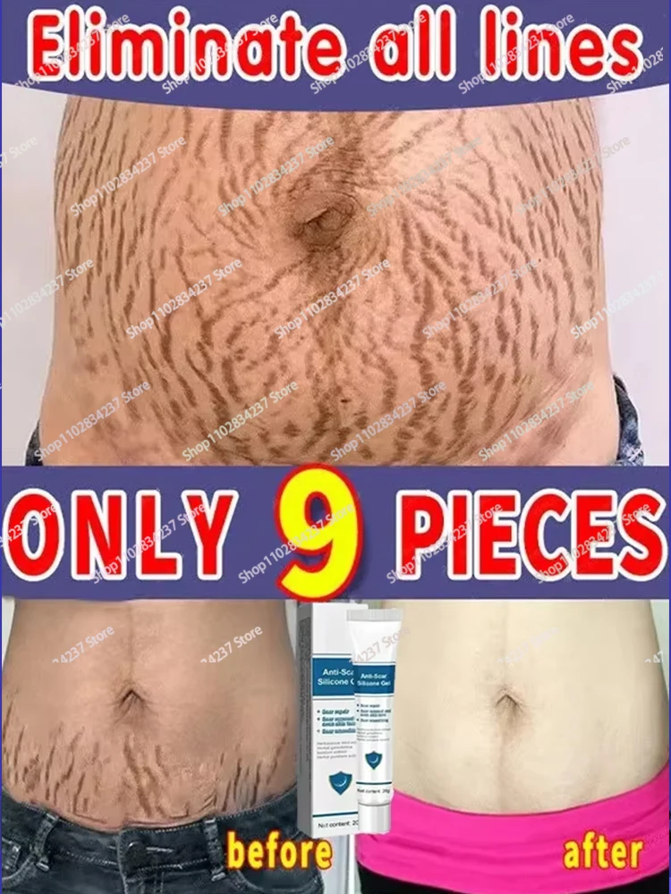 

Permanent Stretch Marks Removal Skin Anti-Wrinkle Pregnancy Body Care