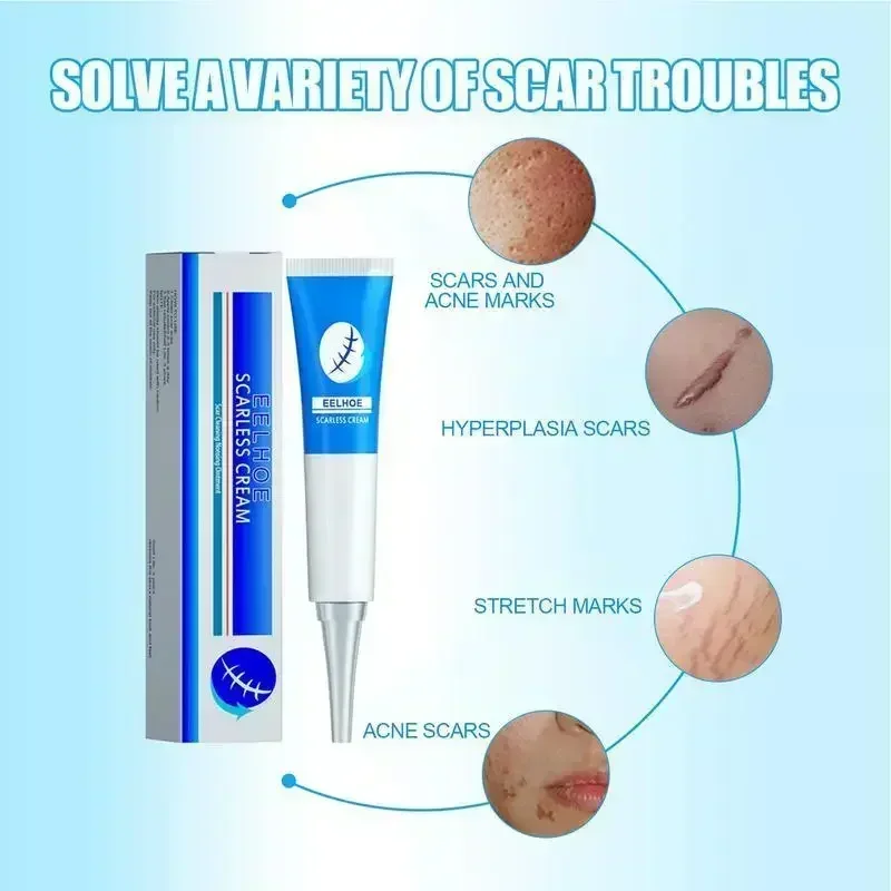 NewScar riparazione efficace cicatrici chirurgiche smagliature acne pits pockmarks burn cicatrici repair treatment 0903