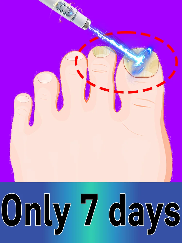 

Quickly restores shine and reduces worries.ʙʟᴜᴇ ʟɪɢʜᴛ ᴘᴇɴ ᴛʀᴇᴀᴛᴍᴇɴᴛ ꜰᴏʀ ᴏɴʏᴄʜᴏᴍʏᴄᴏꜱɪꜱ, HOT