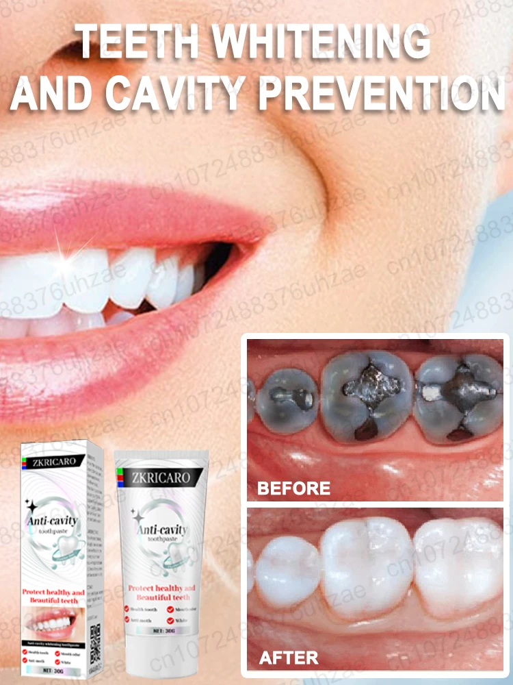 Reparar, prevenir dentes irritantes, remover gesso dental, dor de dente, dentes brancos, aliviar o mau hálito