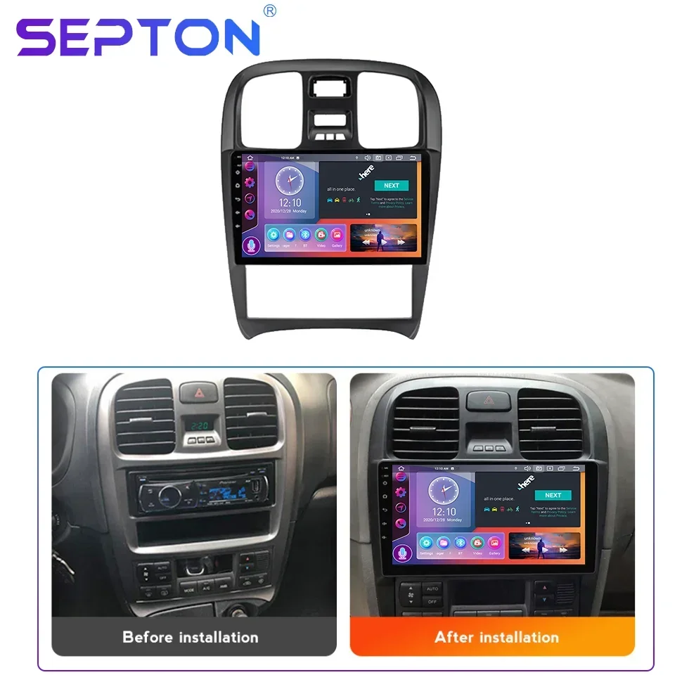 SEPTON  8+256G Multimedia Head Unit Android Car Setero Radio Carplay for Hyundai Sonata 2003-2009 4G Net Navi GPS BT 8core Wifi