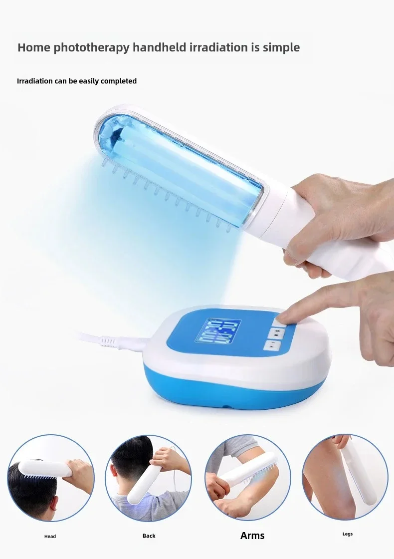 Yonker Medical Equipment Portable 311nm Uv Psoriasis Vitiligo Cream Treatment Uvb Light Lamp 308nm Uvb Phototherapy Machine