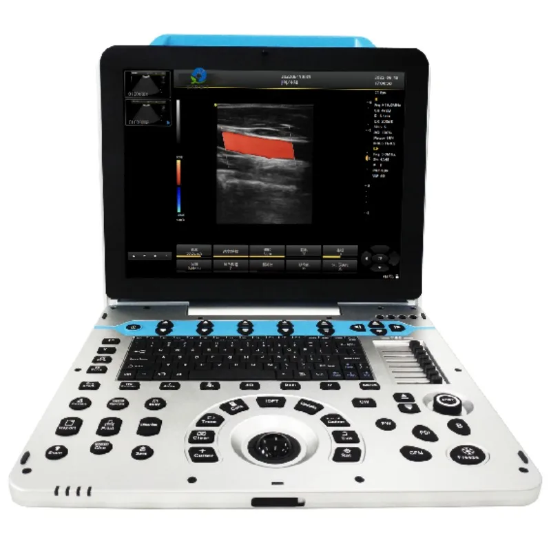 Portable Veterinary 4D/5D Full Digital Ultrasound Scanner with Color Doppler Trolley Sustainable & Easy Operation