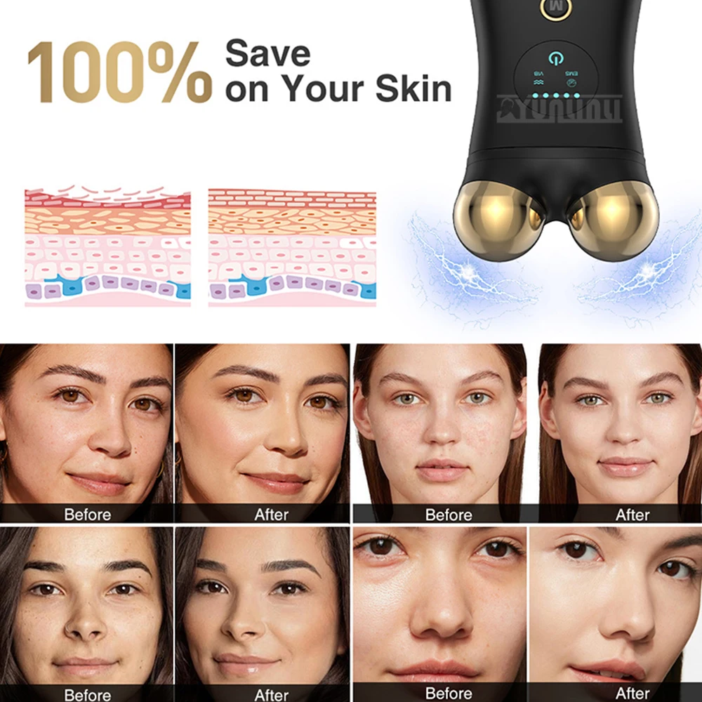 

EMS Beauty Device for Eye Lips Face Slimming Reduces Nasolabial Folds V-Lift