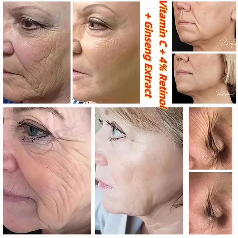 Seoul 1988 Retinol Ginseng Eye & Face Cream Serum Set Firming Moisturizing Diminish Lines Wrinkles Skin Care Essences