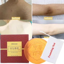 Body Whitening Soap Deep Clean Skin Chicken Skin Removal Soap Armpit Underarm Knees Bleaching Body Brighten White Care Products