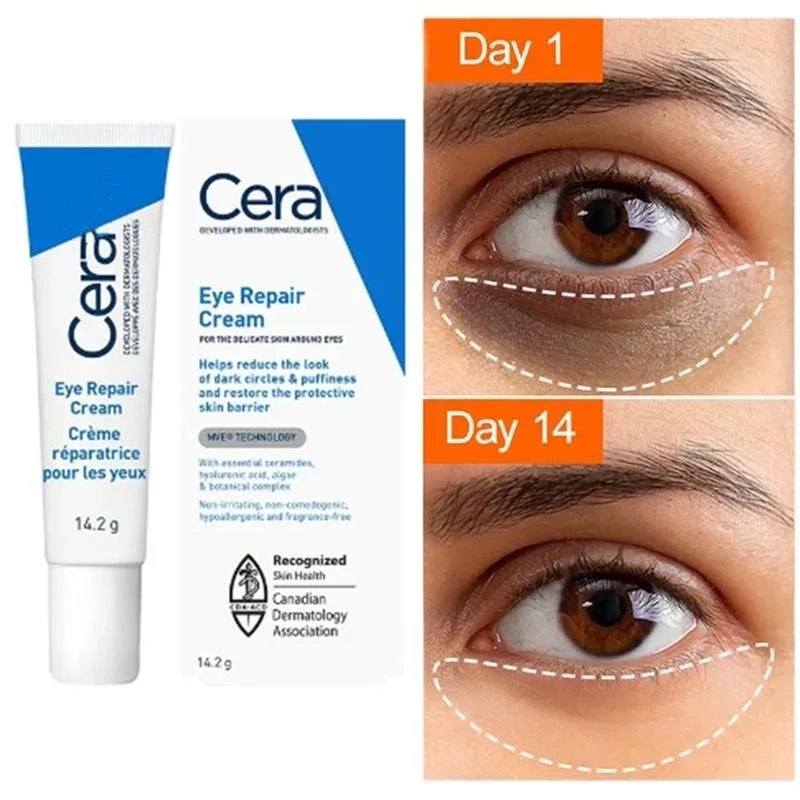 Crème anti-déformable pour les yeux au rétinol, dissolvant de poches sous les yeux, estompe les ridules, hydratante, beauté, santé