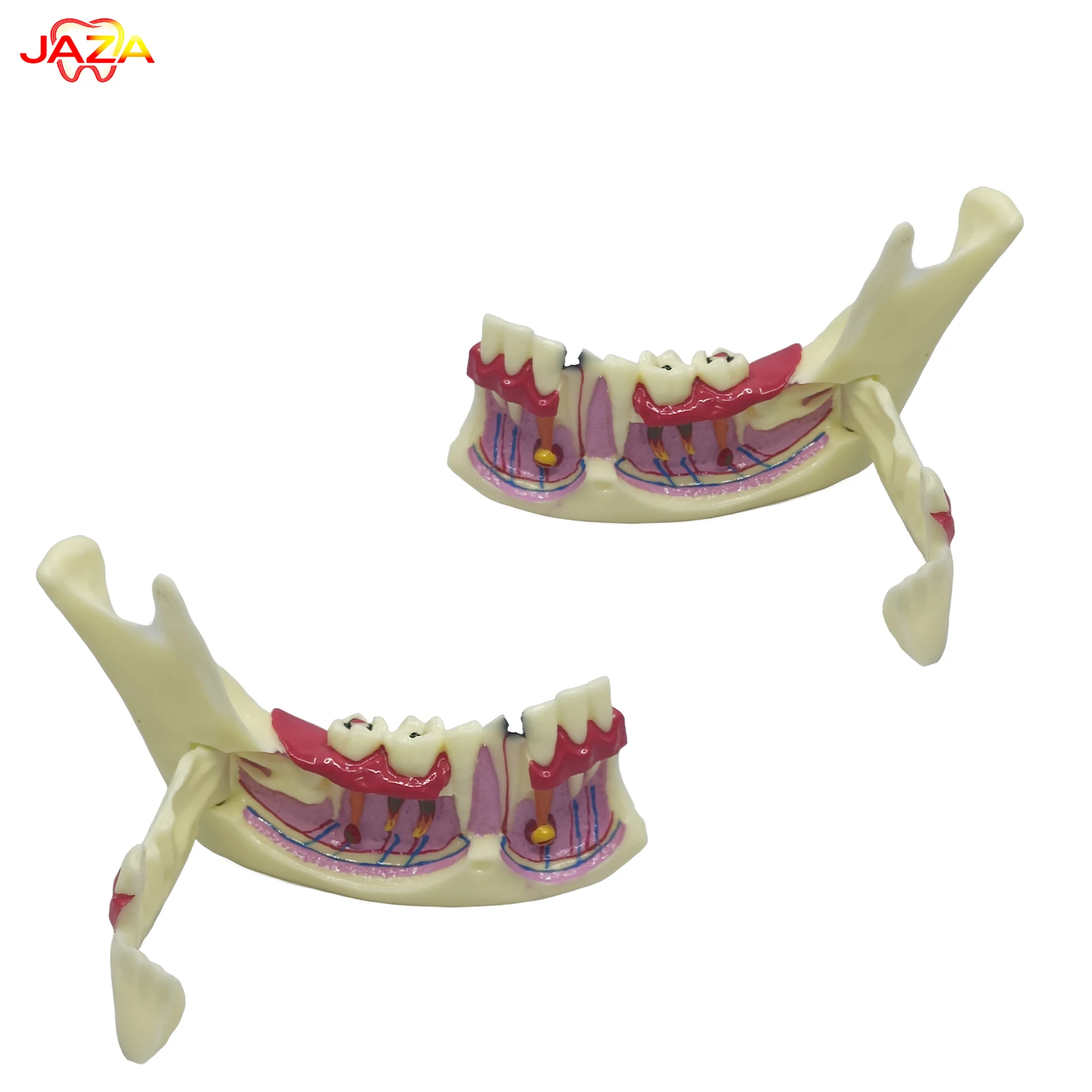 Detachable Lower Jaw Dental Model,Lateral Open Design For Periodontal Disease,Caries And Root Anatomy Demonstration,1:1 Tool