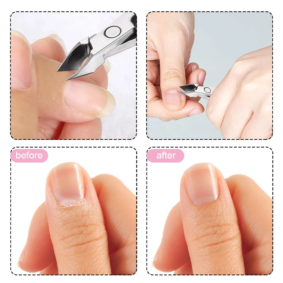 QAZIXU Nail Care Cuticle Remover Nail Polish Softener for Dead Skin Gel Manicure Treatment Tool or Pedicure Nails Care