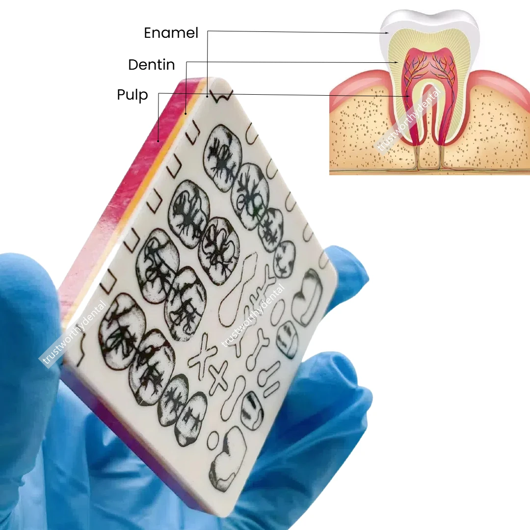 Dental Learn-A-Prep II Tooth Preparation Trainer Blocks 3 Layers Cavity Preparation Trainers Enamel Dentin Pulp Layer Practise