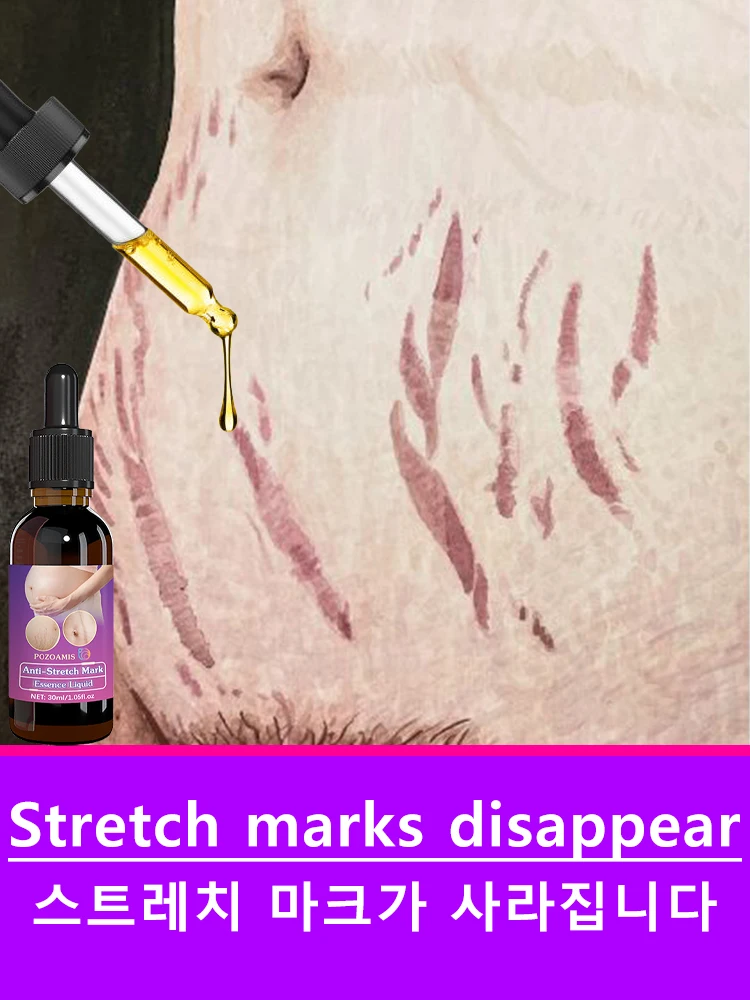 Stretch Mark Fading Serum A body oil suitable for pregnant women; it helps fade stretch marks, hydrates the skin, and soothes it.