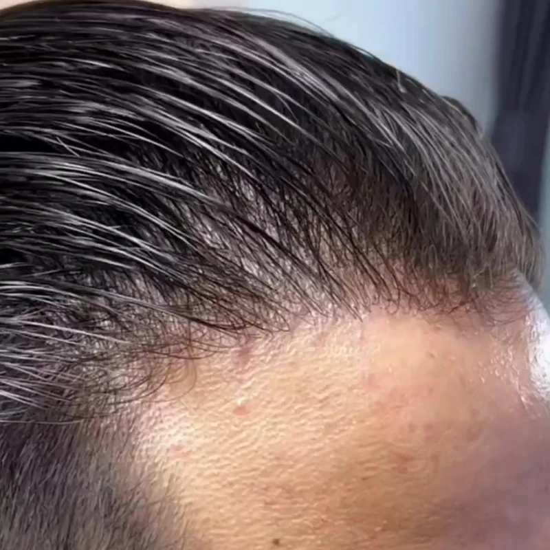 Male Toupee 80% Density #1B 0.02mm Undetectable Thin Skin Natural Hairline Human Hair Replacement System for Hair Loss Wear&Go