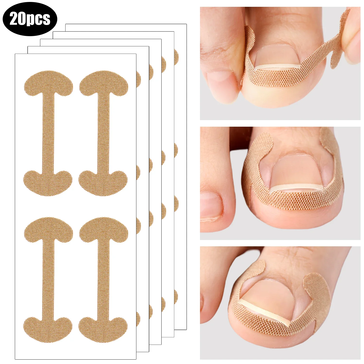 20-100pcs Adhesive Toenail Patch Ingrown Toe Nail Correction Sticker Foot Corrector Pedicure Health Care Tools Toe Treatment Pad