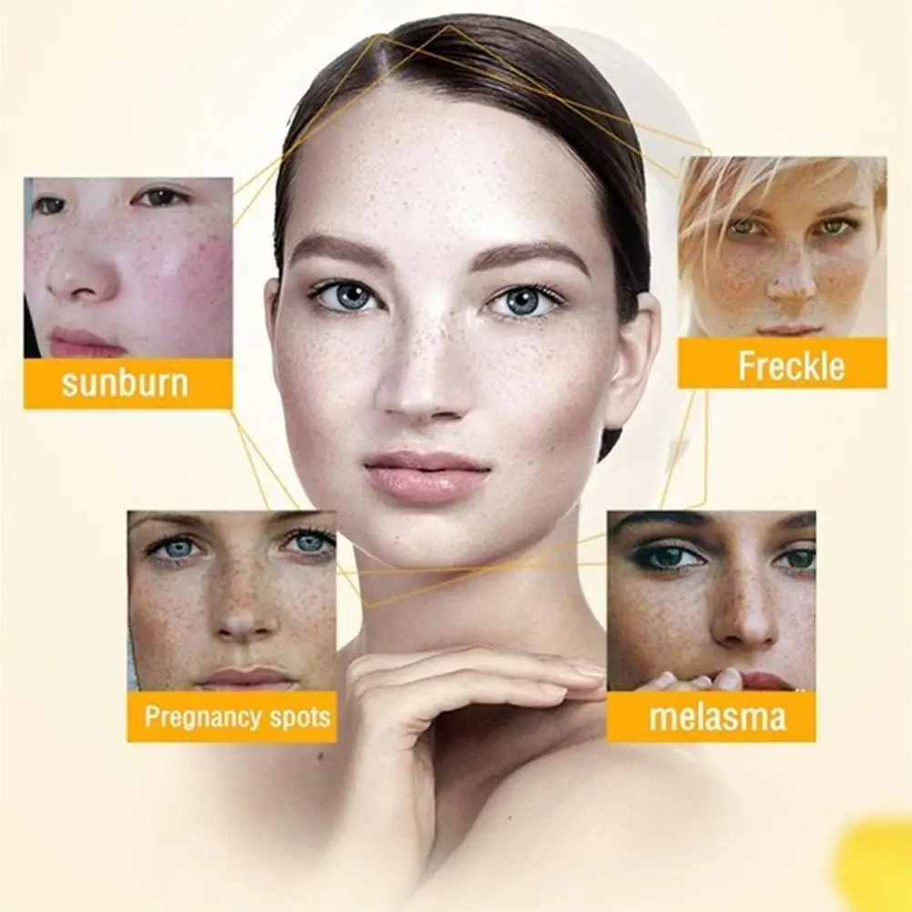 Face Skin Care Whitening Freckles Cream Remove Melasma Dark Spots Lighten Remover Moisturizing Brightening 20ml