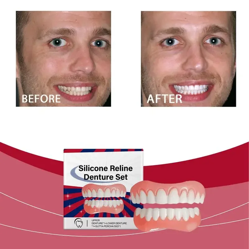 Silicone Denture Set Silicone Upper Lower Veneers Laugh Soft Denture Kit  Silicone Liners Soft  Kit fake Denture