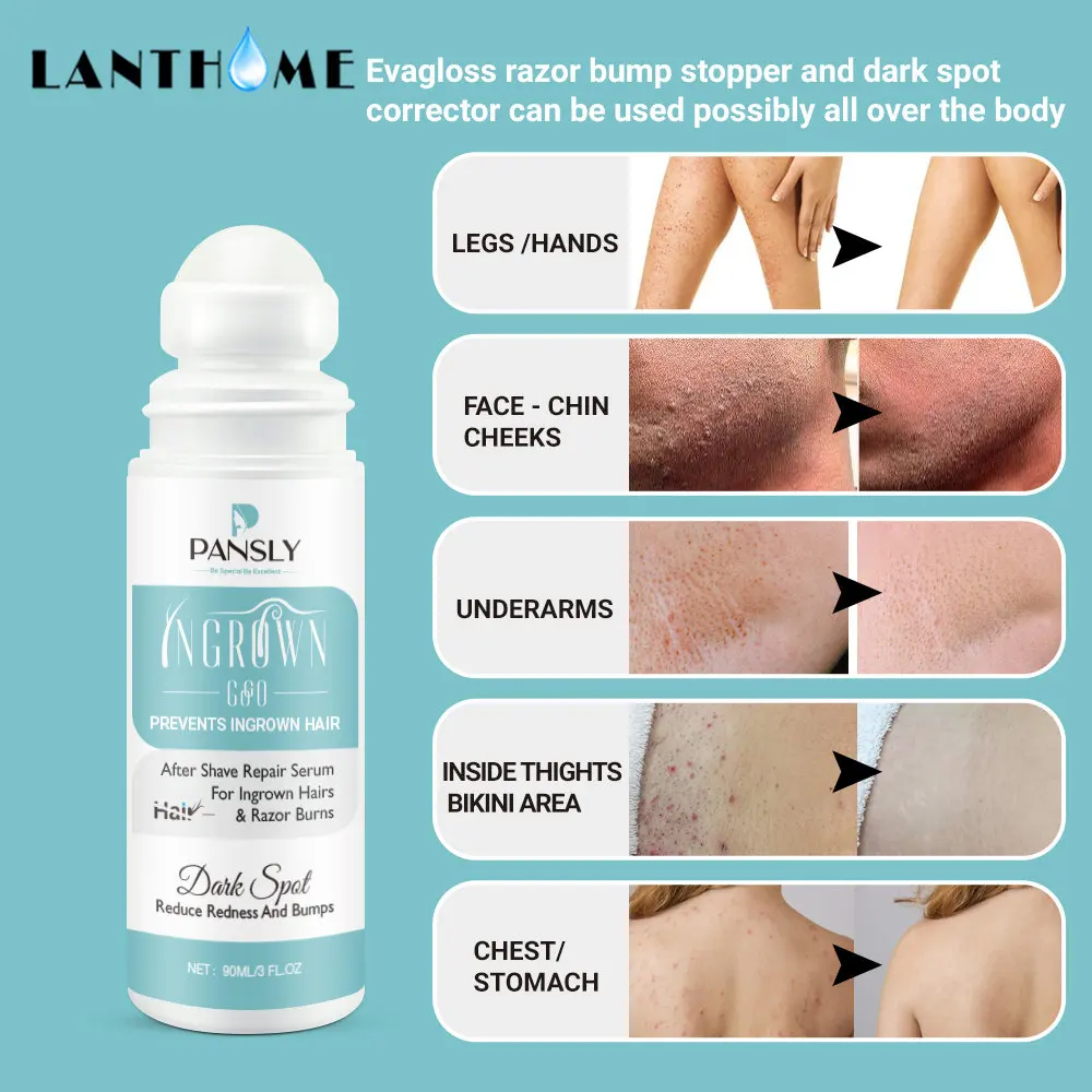 Ingrown Hairs Treatment  After Shave Repair Dark Spot Serum for Vanish Pfb and Razor Burns Black Men and Bikini Area Care