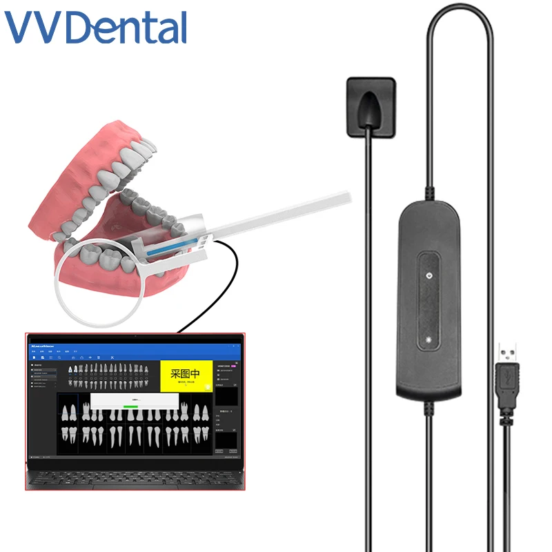 VVDental Dental Sensor X-Ray High-Frequency Rx Intraoral Digital System  Dental Digital Sensor HD Image Radiovisografo